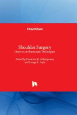 Shoulder Surgery - Open Vs Arthroscopic Techniques