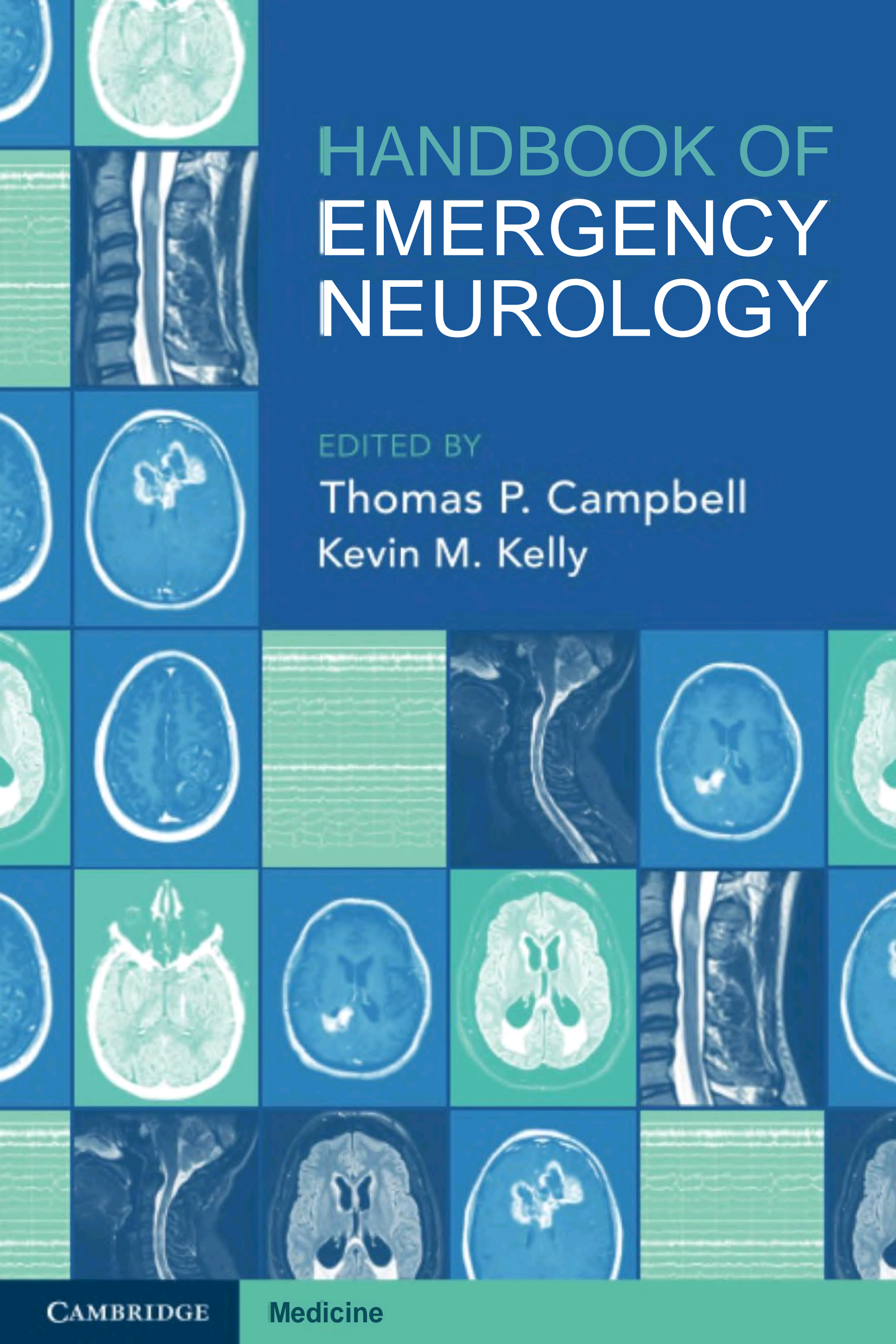 Handbook of Emergency Neurology (Thomas P. Campbell, Kevin M. Kelly