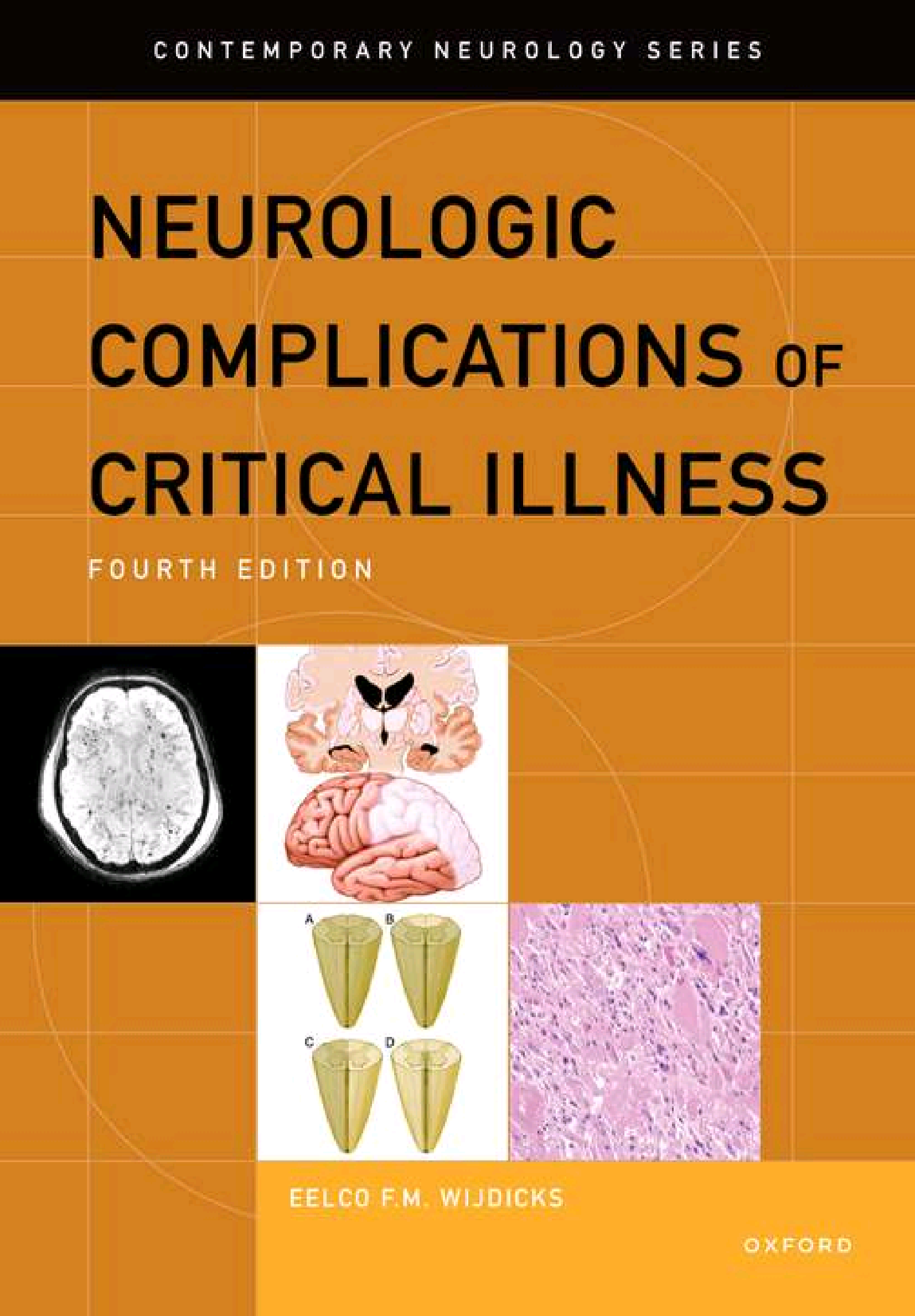 Neurologic Complications of Critical Illness (CONTEMPORARY NEUROLOGY SERIES)