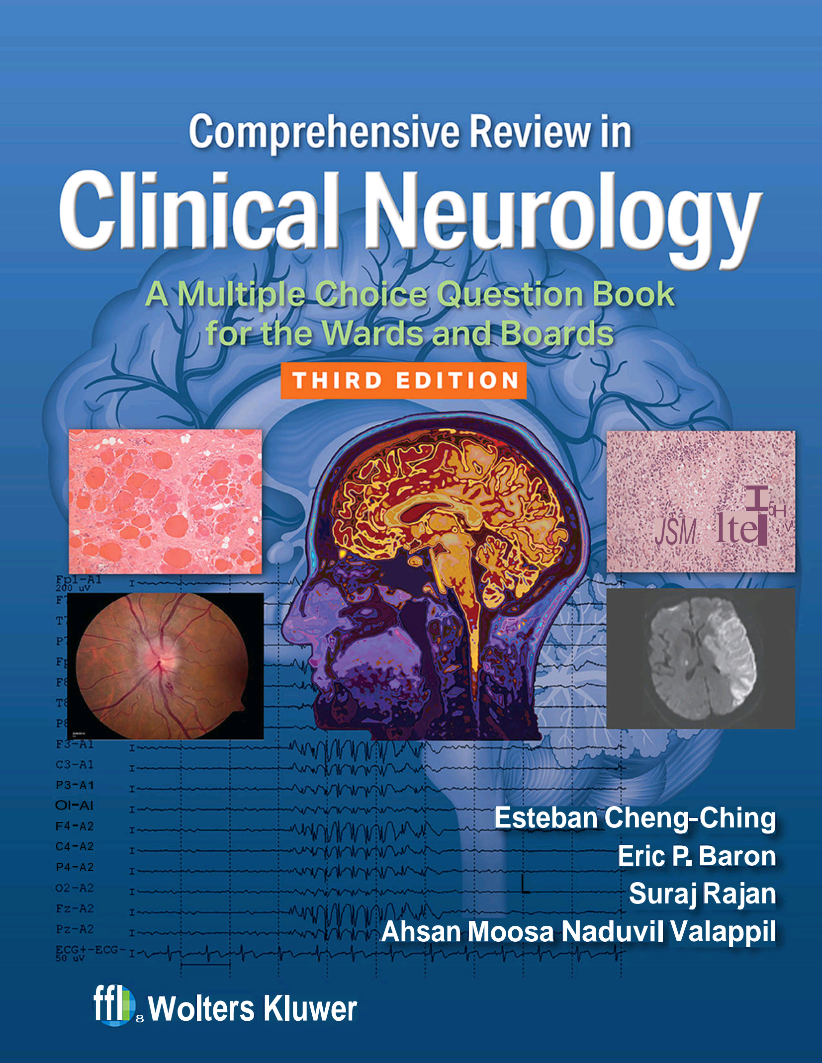 Comprehensive Review in Clinical Neurology A Multiple Choice Question Book for the Wards and Boards