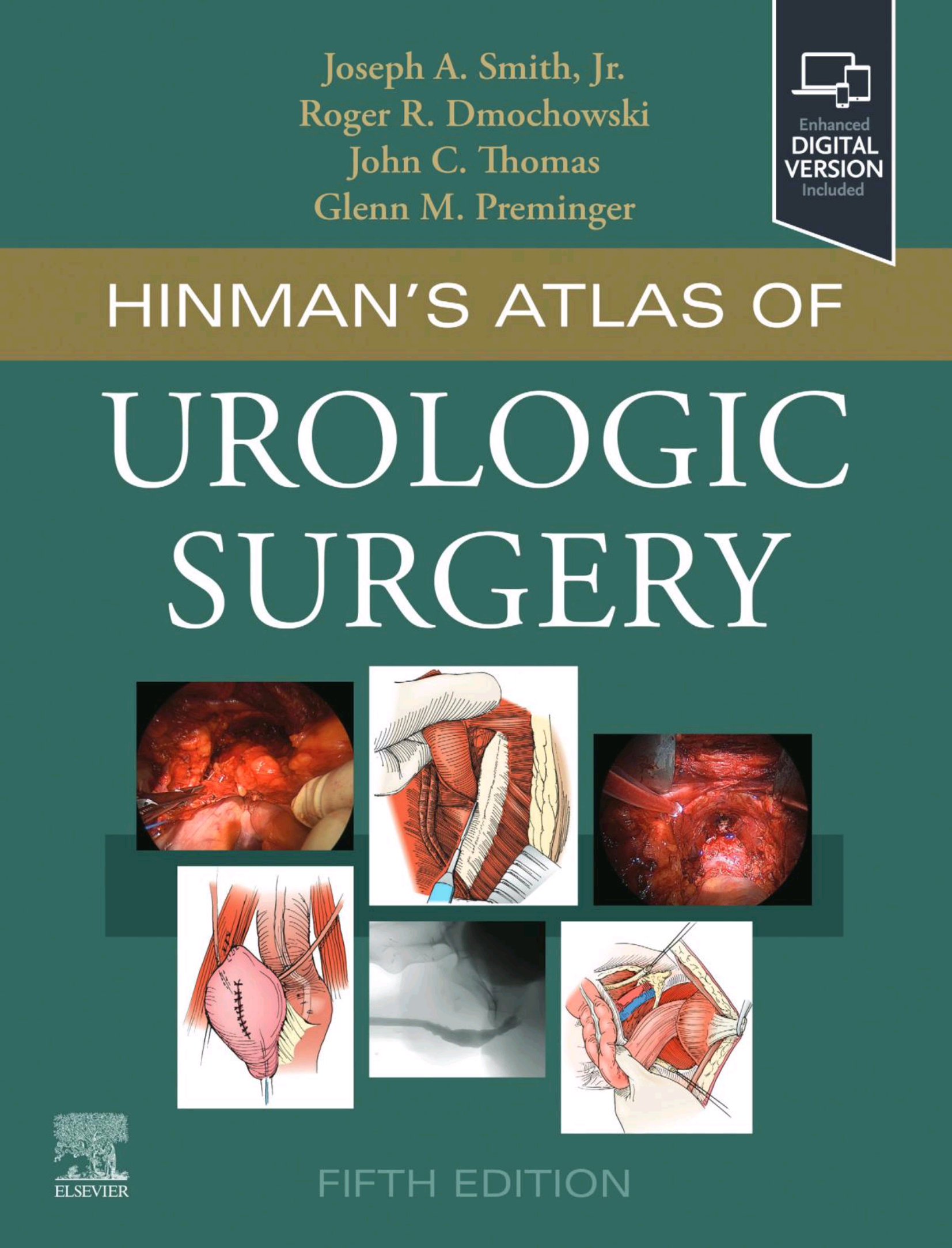 Hinmans Atlas of Urologic Surgery