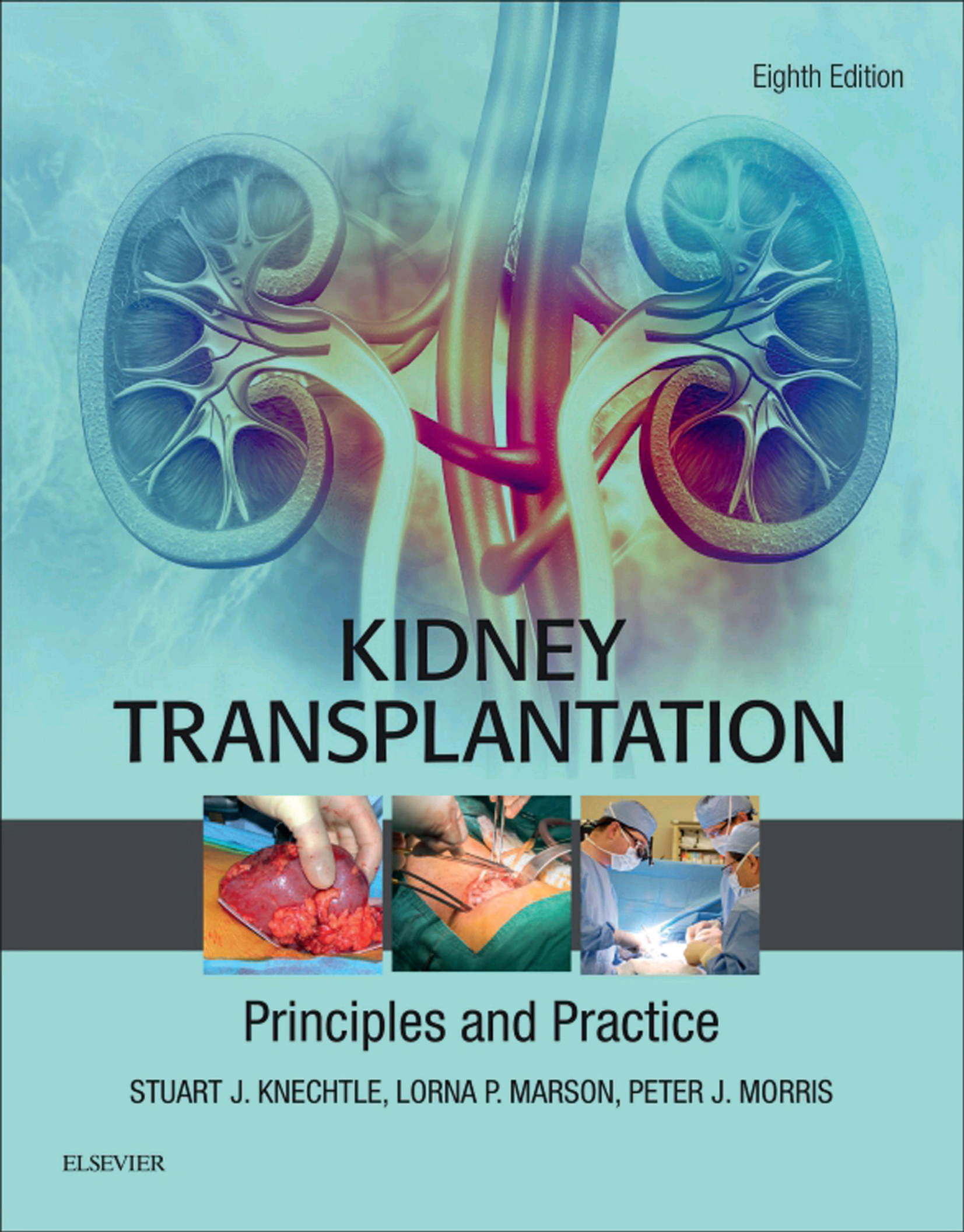 Kidney Transplantation Principles and Practice 8th Edition