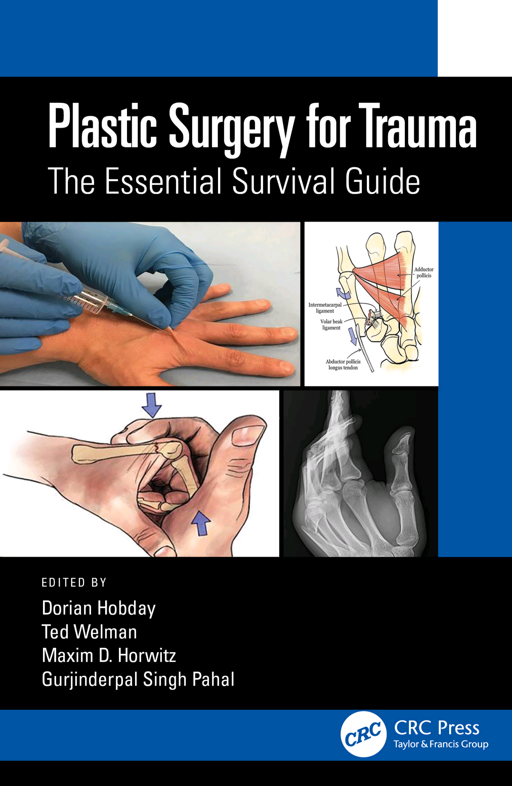 Plastic Surgery for Trauma; The Essential Survival Guide