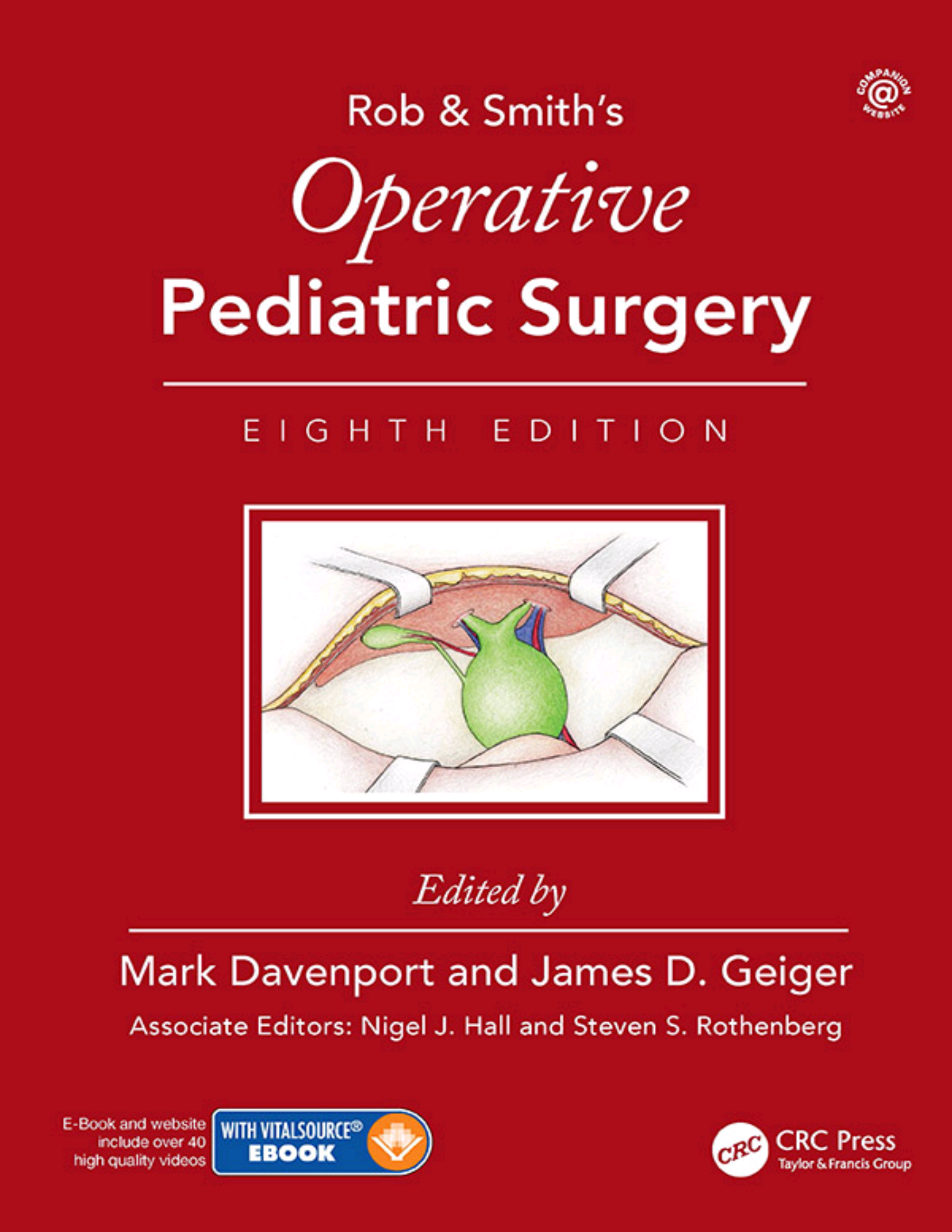 Rob  Smiths Operative Pediatric Surgery